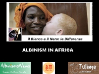 video: Albinismo in Africa. Cosa significa